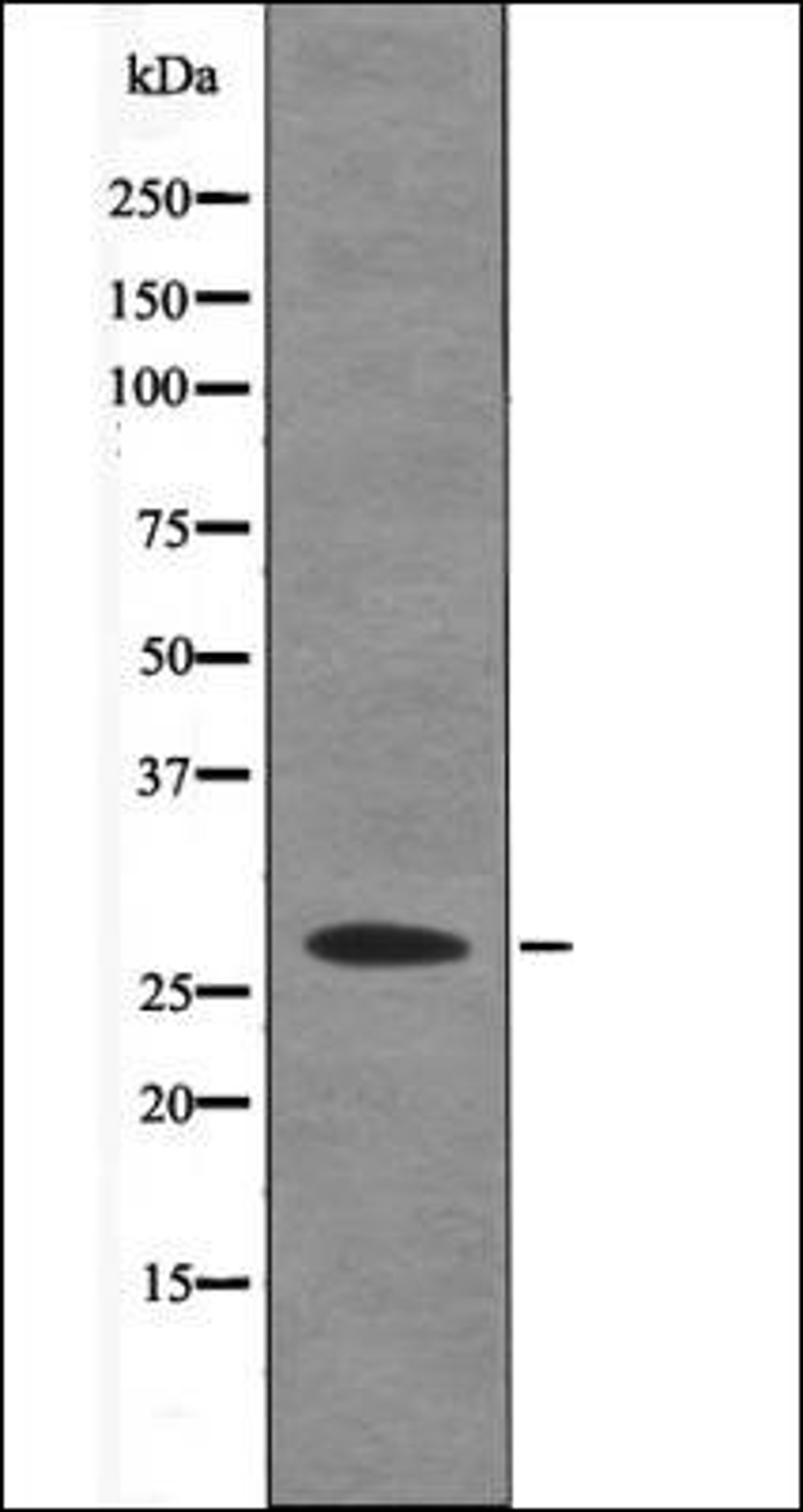 Western blot analysis of Insulin treated HT29 whole cell lysates using Caveolin 2 -Phospho-Ser36- antibody