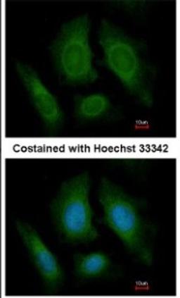 Immunocytochemistry/Immunofluorescence: OSBPL6 Antibody [NBP1-31456] - Paraformaldehyde-fixed HeLa, using antibody at 1:200 dilution.