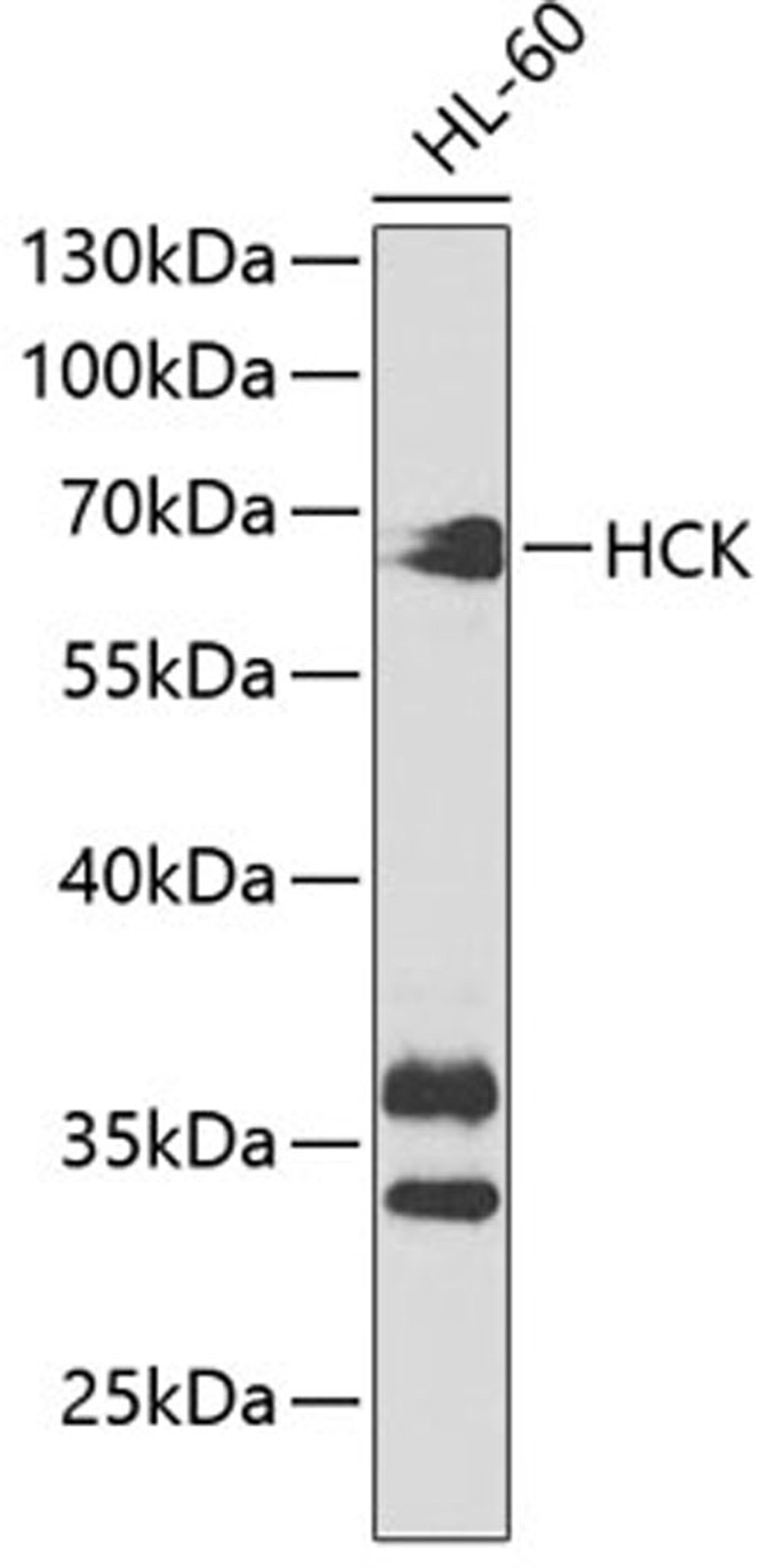 Western blot - HCK antibody (A2083)