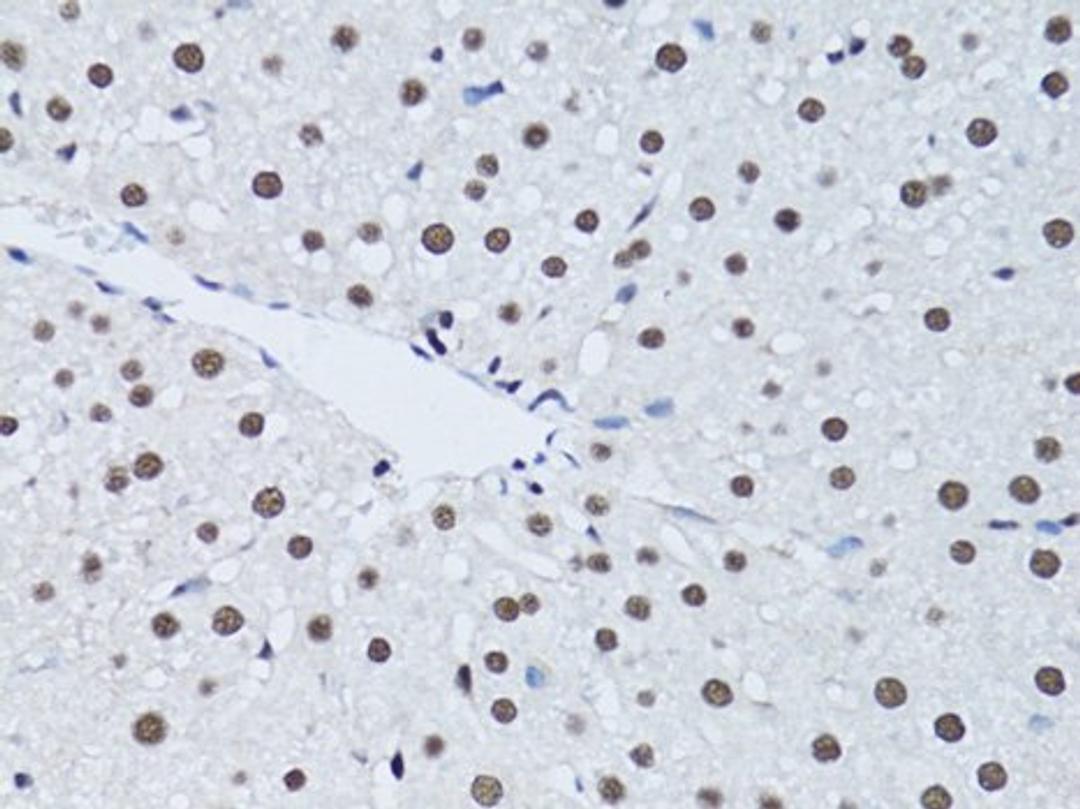 Immunohistochemistry of paraffin-embedded rat liver using PCNA antibody