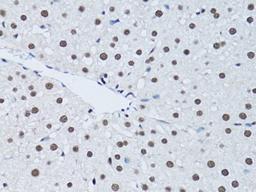 Immunohistochemistry of paraffin-embedded rat liver using PCNA antibody