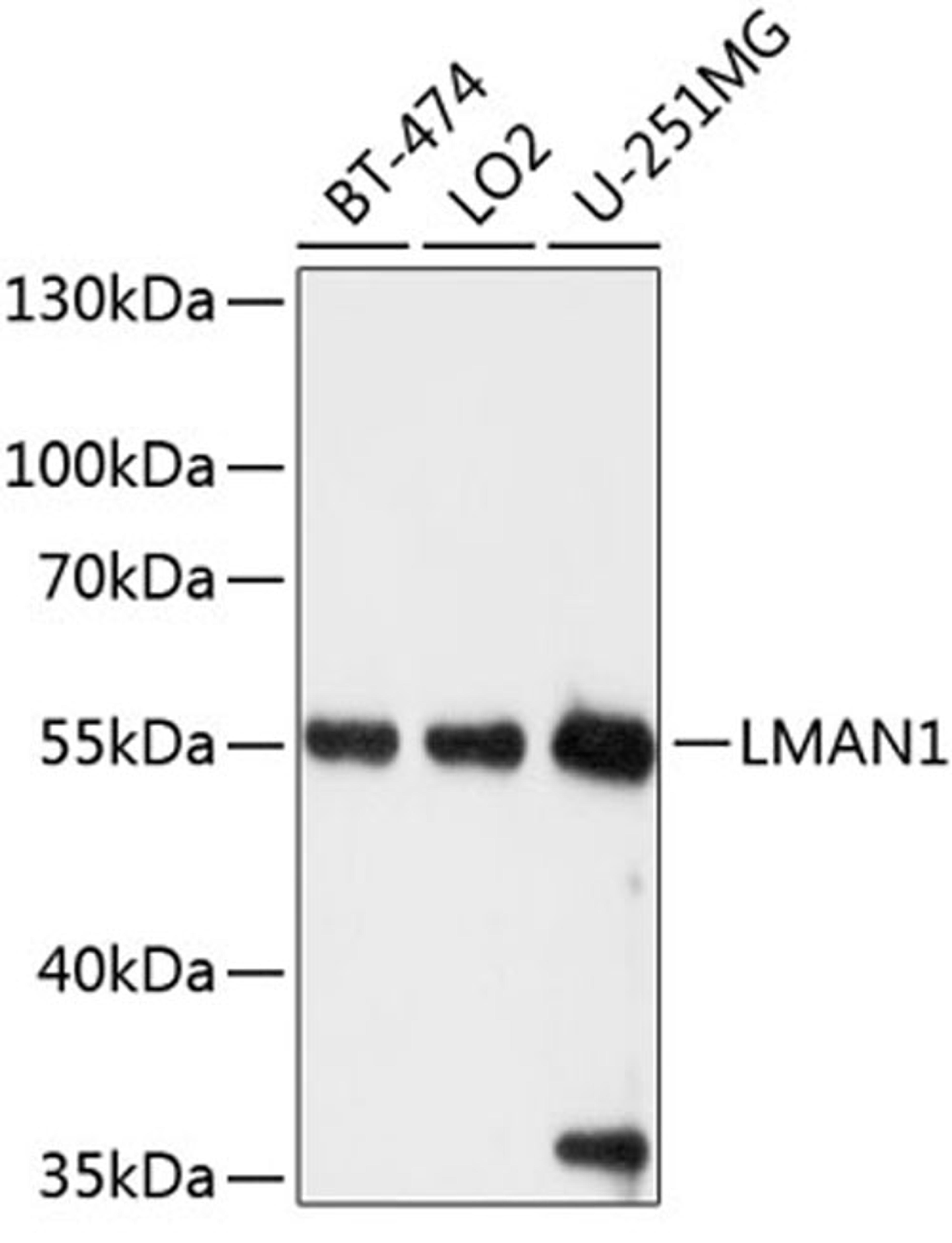 Western blot - LMAN1 antibody (A10440)