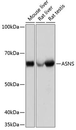 Western blot - ASNS Rabbit mAb (A1030)