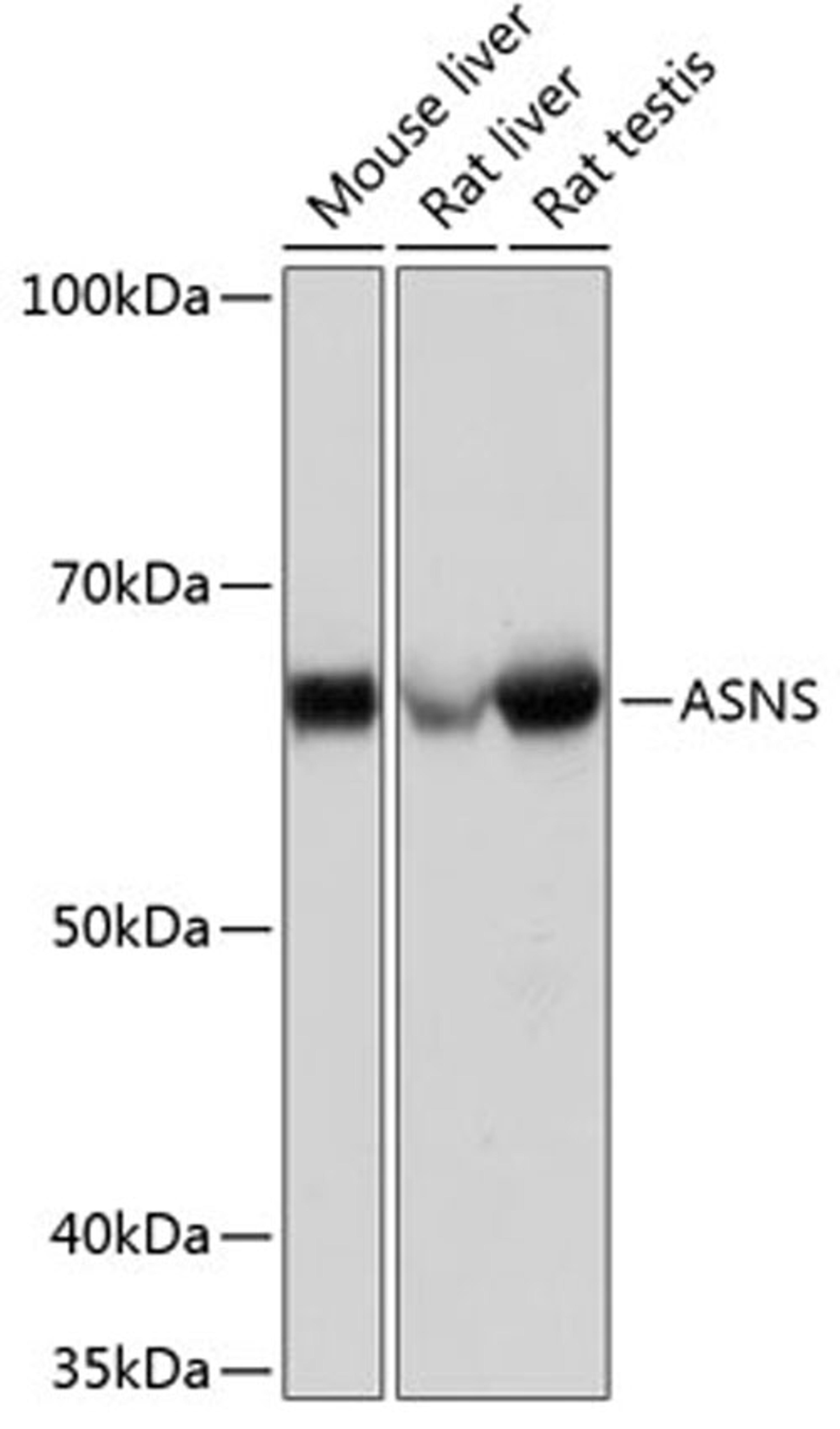 Western blot - ASNS Rabbit mAb (A1030)