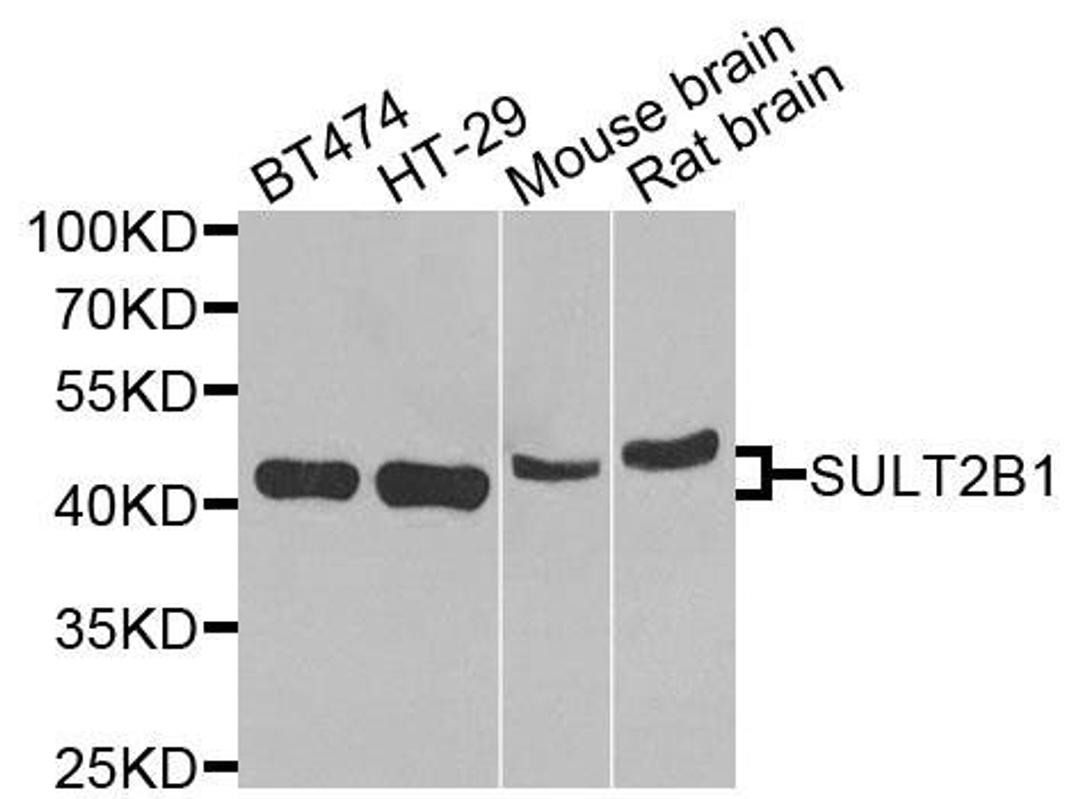 Western blot analysis of extracts of various cells using SULT2B1 antibody