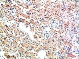Immunohistochemical analysis of paraffin-embedded Rat Kidney Tissue using IkB α Rabbit pAb diluted at 1:200