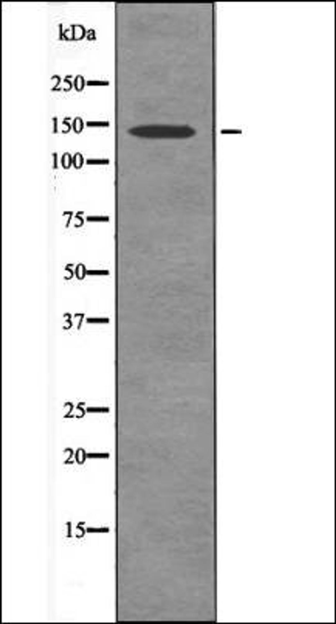 Western blot analysis of HeLa whole cell lysates using PASK -Phospho-Thr1165- antibody