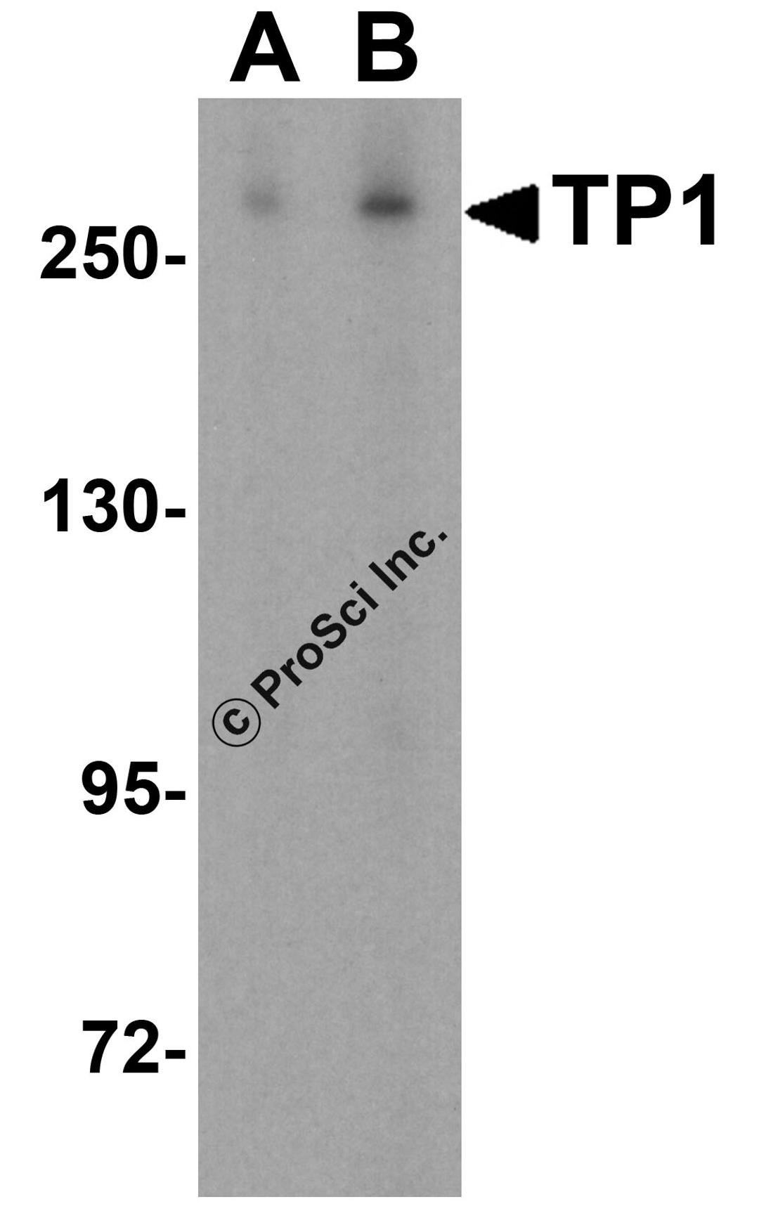Western blot analysis of TP1 in human kidney tissue lysate with TP1 antibody at (A) 0.5 and (B) 1 μg/mL.