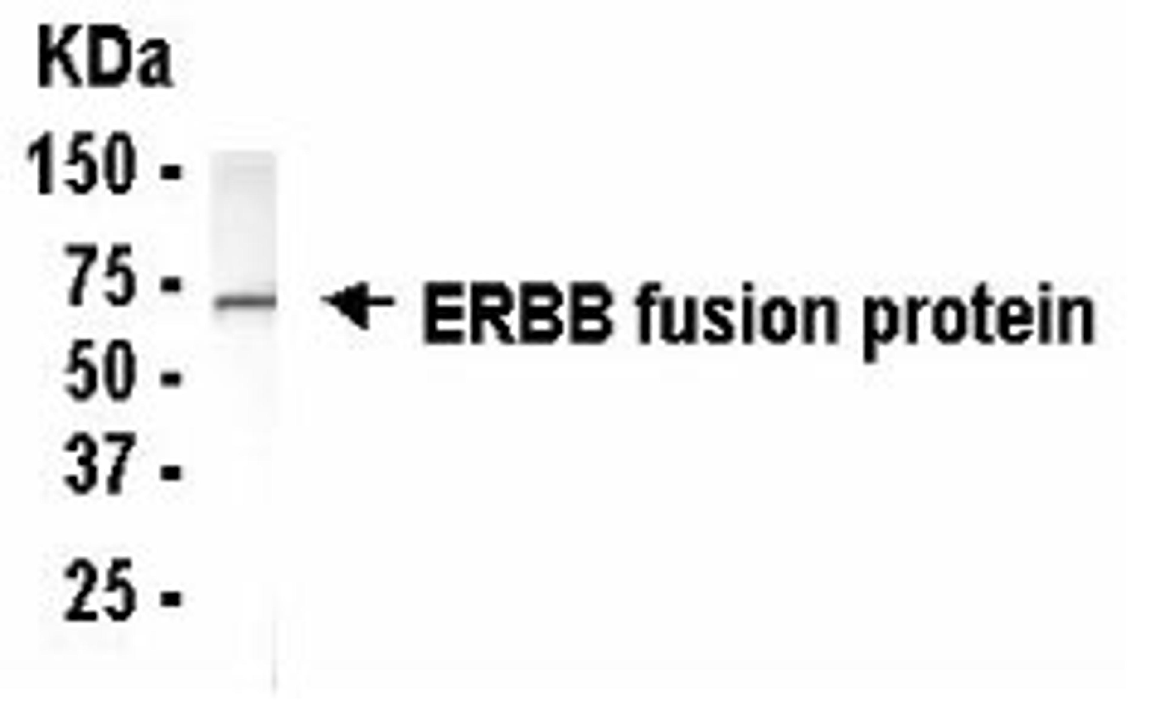 Western Blot: E coli-derived fusion protein as test antigen. XW-7180 dilution: 1/2000, Goat anti-IgY-HRP dilution: 1/1000. Colorimetric method for signal development