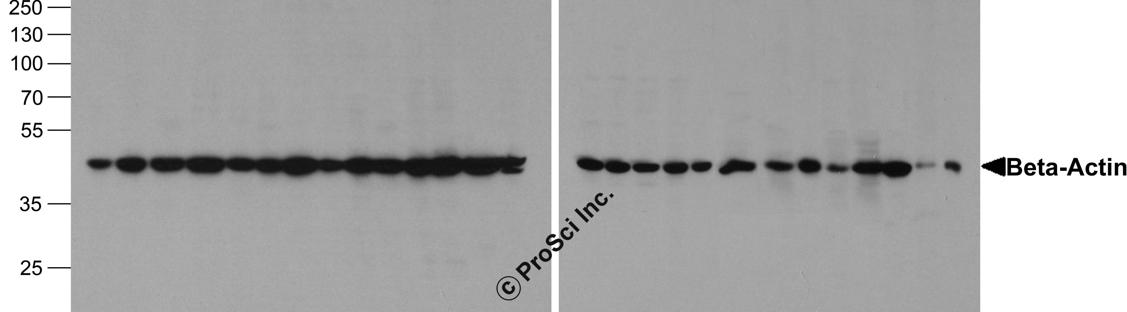 Western blot analysis of Beta-Actin in 293, A431, A549, Daudi, HeLa, HepG2, Jurkat, K562, MOLT, 3T3, Raji, Ramos, THP-1, U937, human brain, mouse brain, rat brain, rabbit brain, mouse lung, rat lung, rat liver, rabbit liver, rabbit spleen, chicken liver,