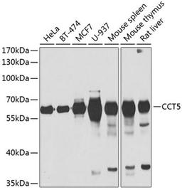 Western blot - CCT5 antibody (A6549)