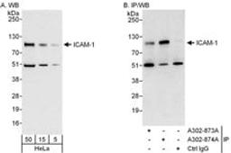 Detection of human ICAM-1 by western blot and immunoprecipitation.