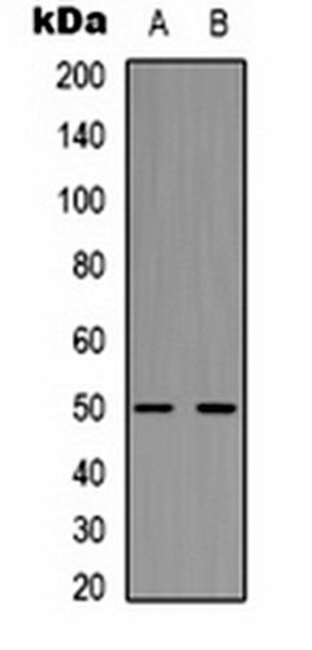 Western blot analysis of mouse brain (Lane 1), rat brain (Lane 2) whole cell lysates using Beta2A-tubulin antibody