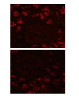 Immunocytochemistry/Immunofluorescence: LRP2 Antibody (CD7D5) [NB110-96417] -  Immunofluorescence staining of Megalin in the brush border of the proximal tubule.