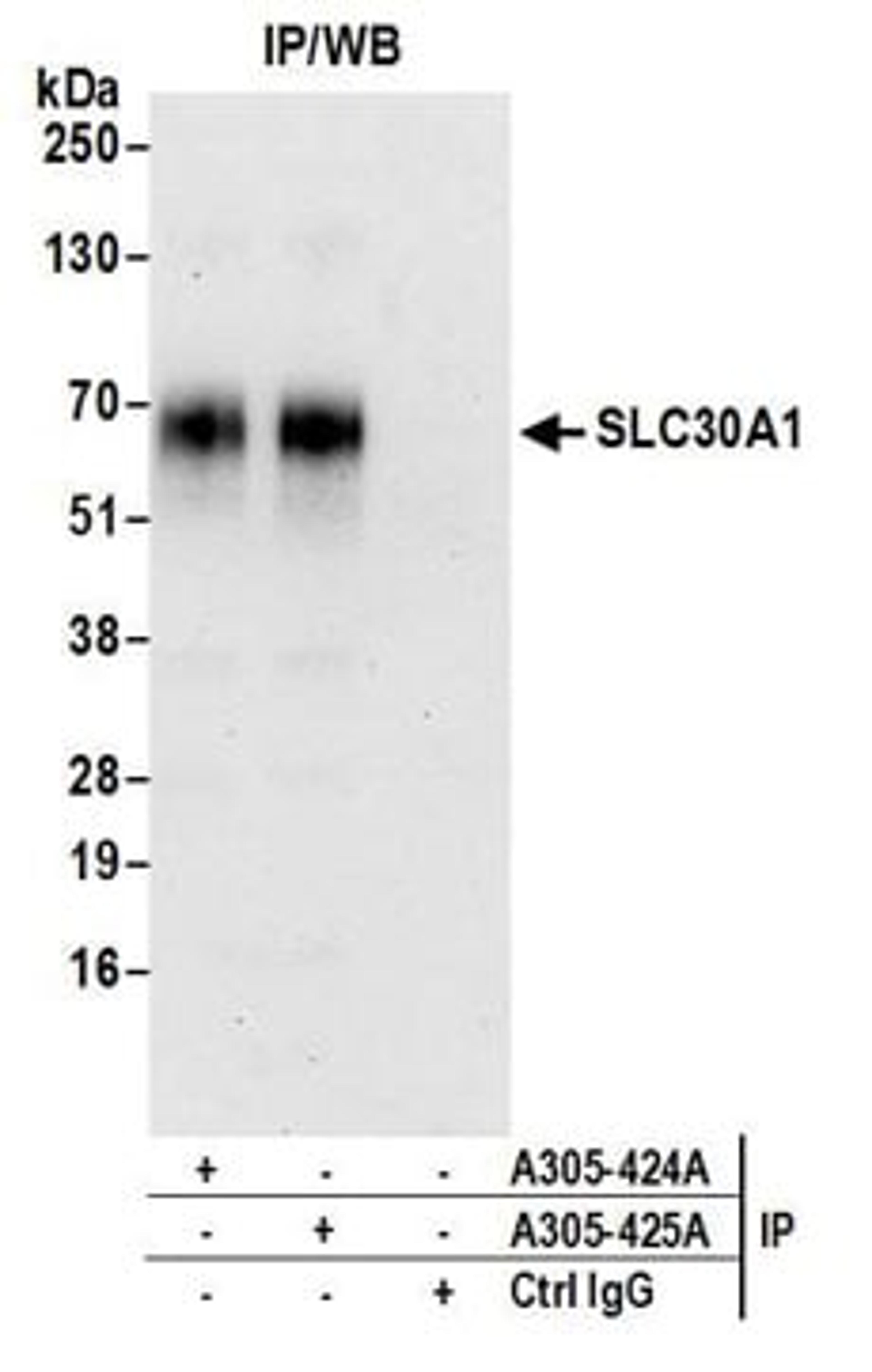 Detection of human SLC30A1 by western blot of immunoprecipitates.