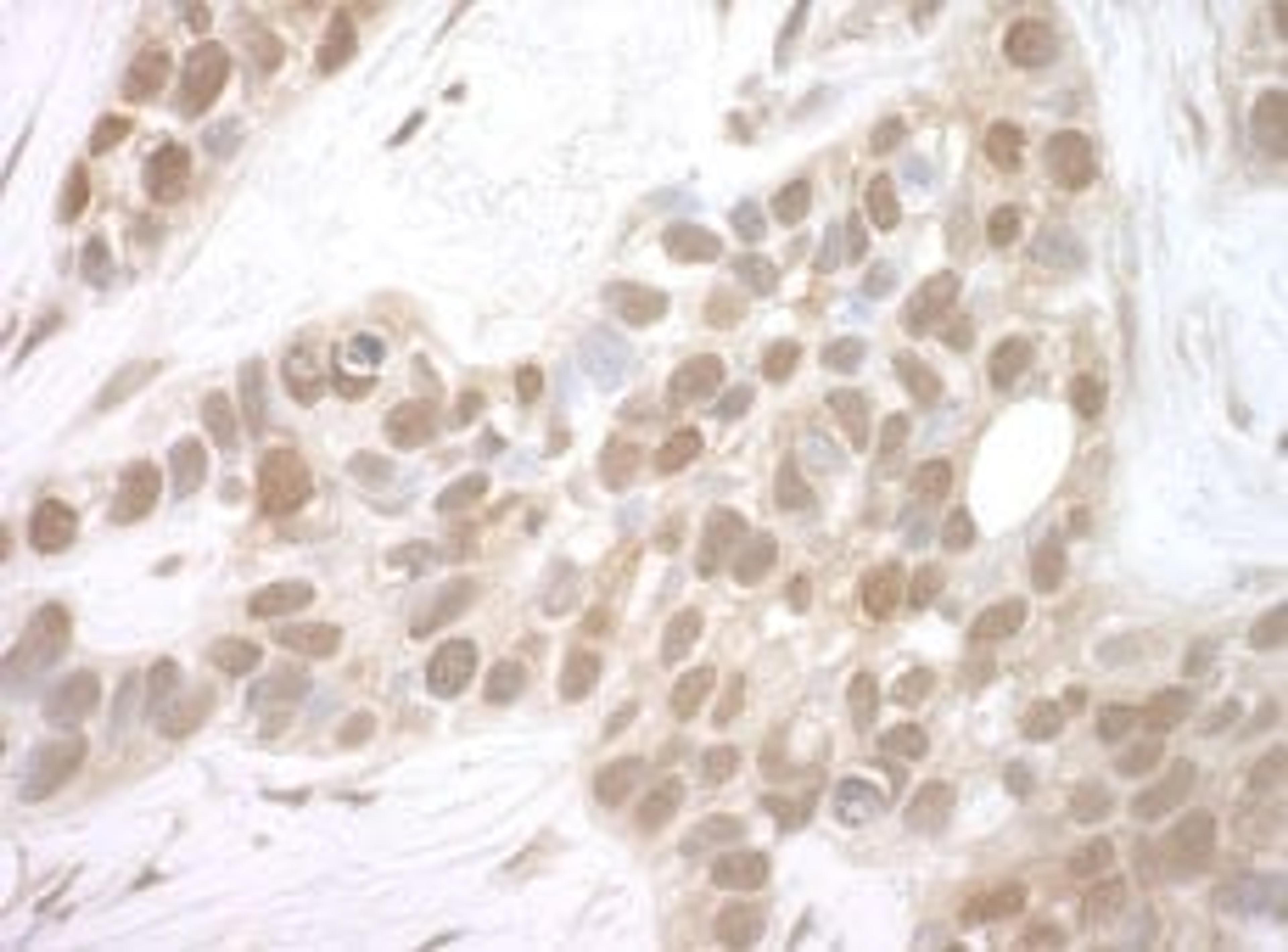 Detection of human MERIT40 by immunohistochemistry.