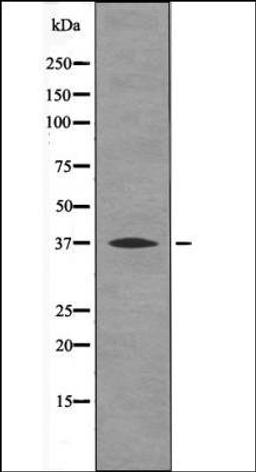 Western blot analysis of PMA treated NIH-3T3 whole cell lysates using BCL-10 -Phospho-Ser138- antibody