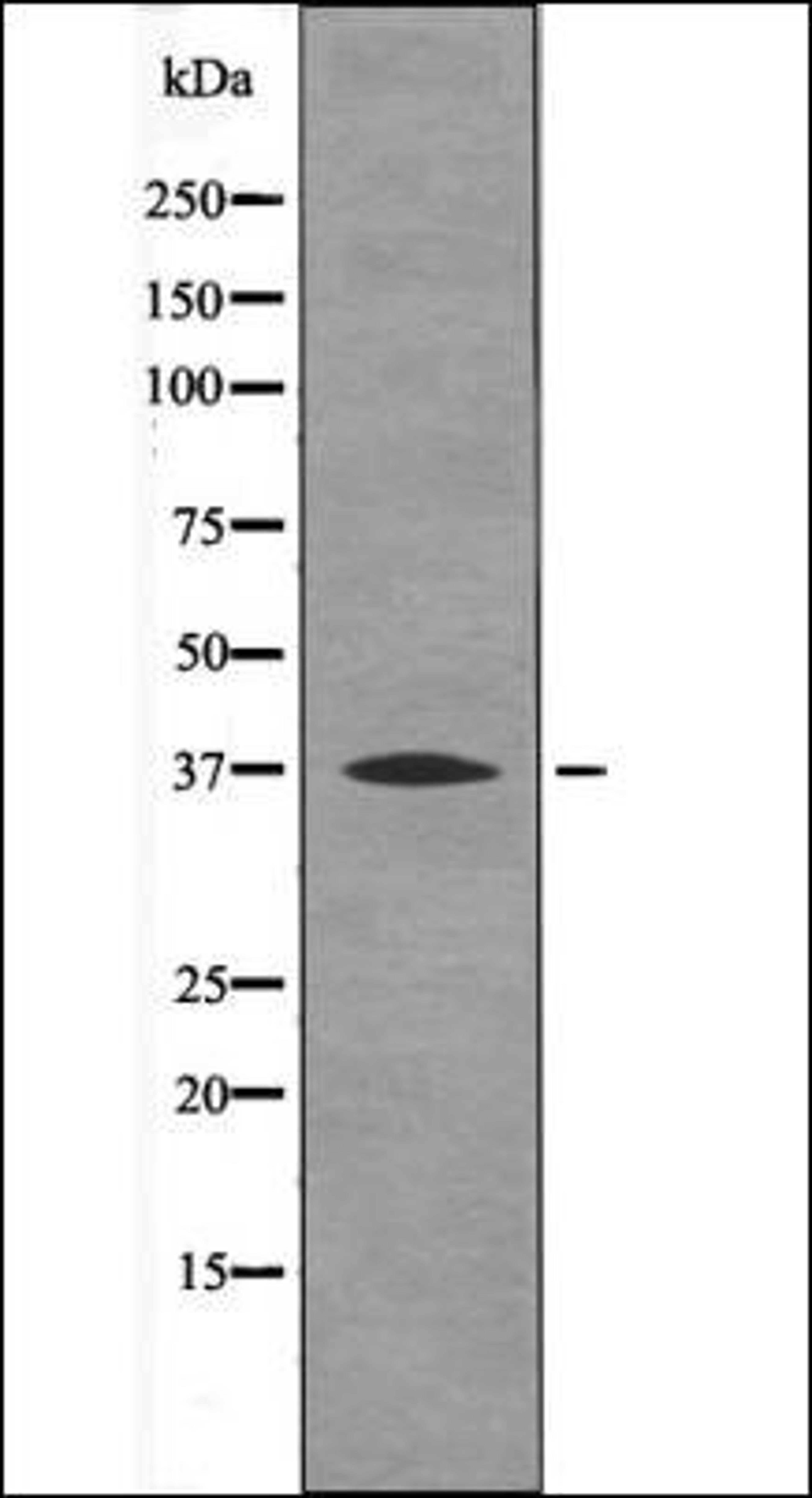 Western blot analysis of PMA treated NIH-3T3 whole cell lysates using BCL-10 -Phospho-Ser138- antibody