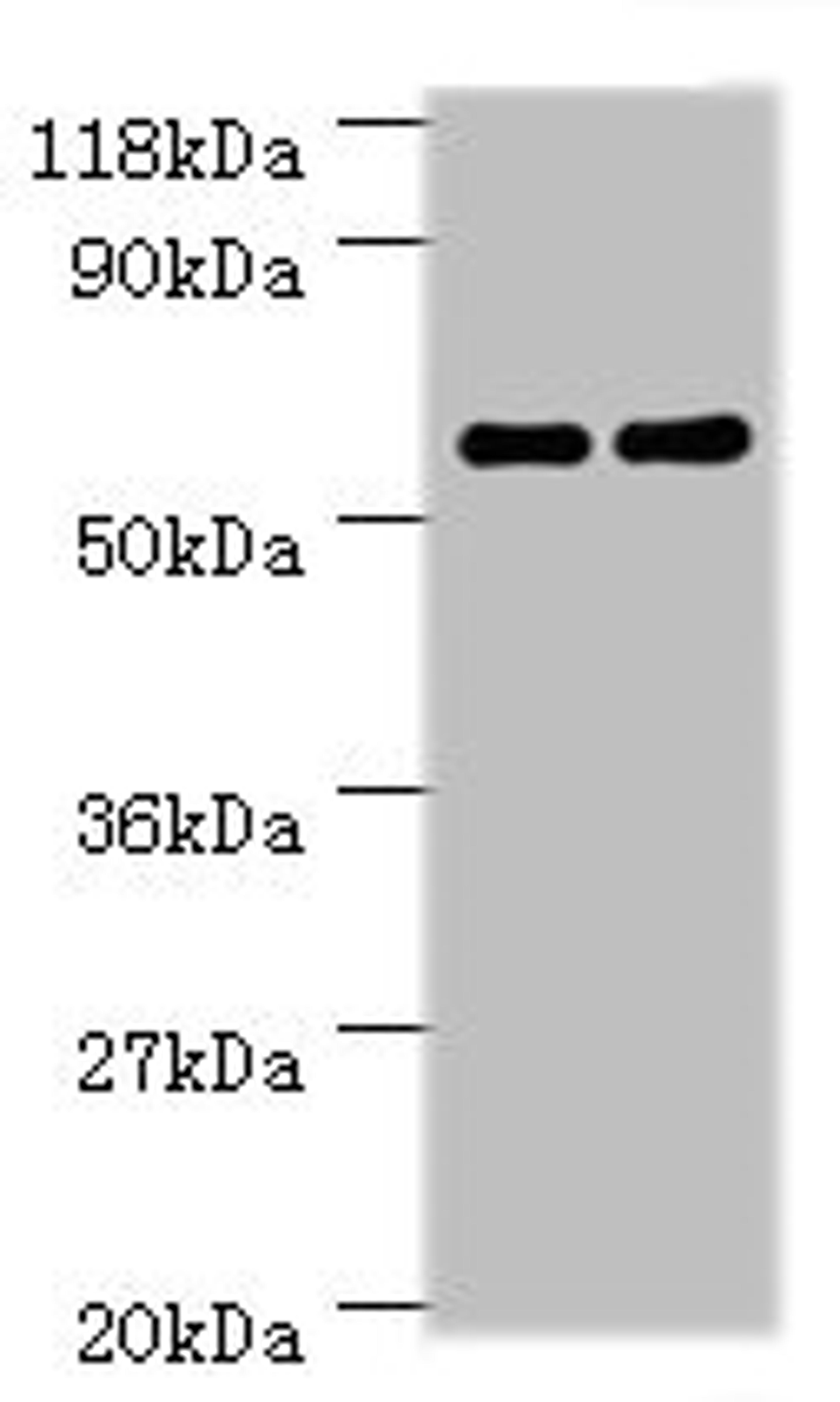 Western blot. All lanes: Ces1c antibody at 2ug/ml. Lane 1: Mouse liver tissue. Lane 2: Rat liver tissue. Secondary. Goat polyclonal to rabbit IgG at 1/10000 dilution. Predicted band size: 62 kDa. Observed band size: 62 kDa. 