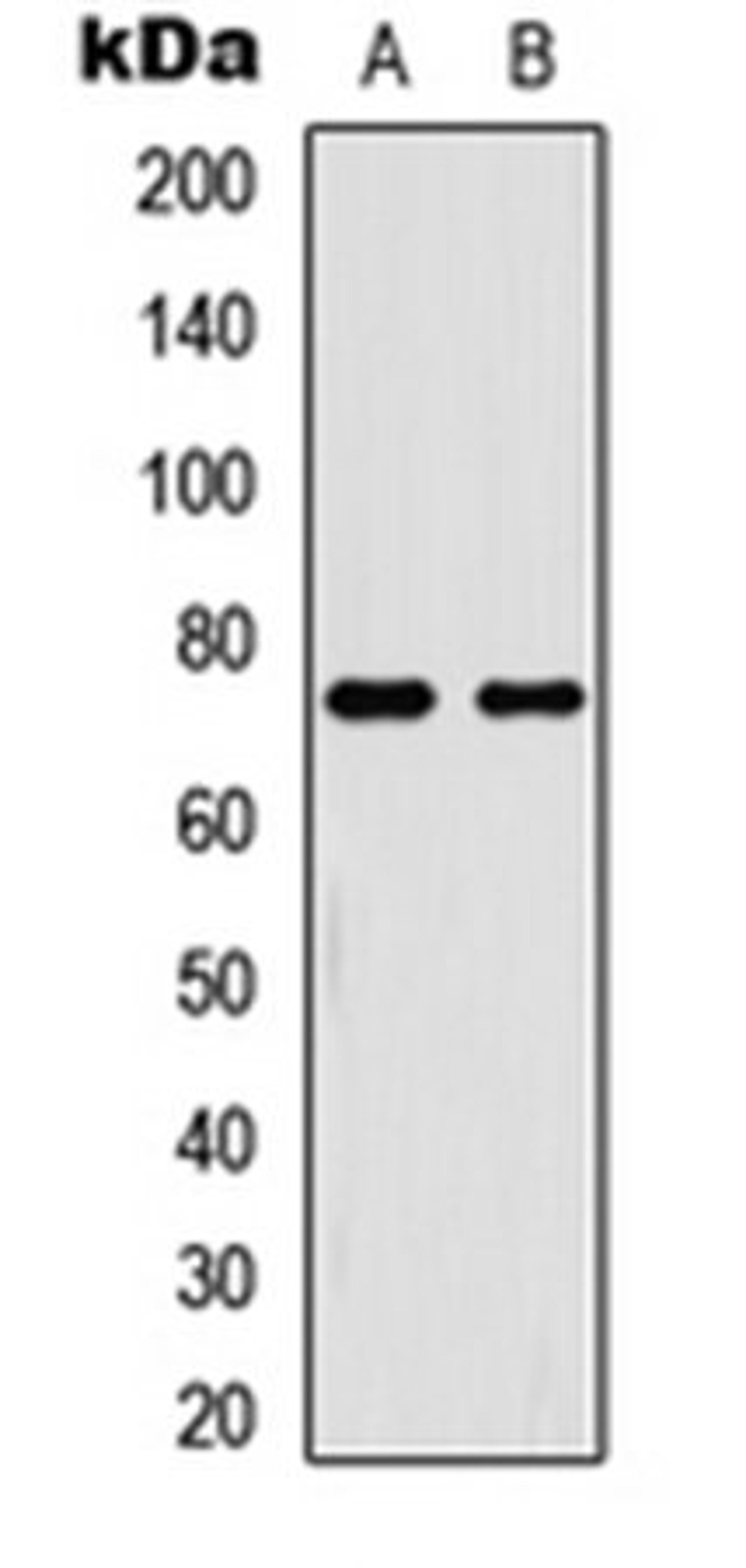 Western blot analysis of HeLa TNFa-treated (Lane 1), HL60 TNFa-treated (Lane 2) whole cell lysates using NF-kappaB p65 (phospho-T254) antibody