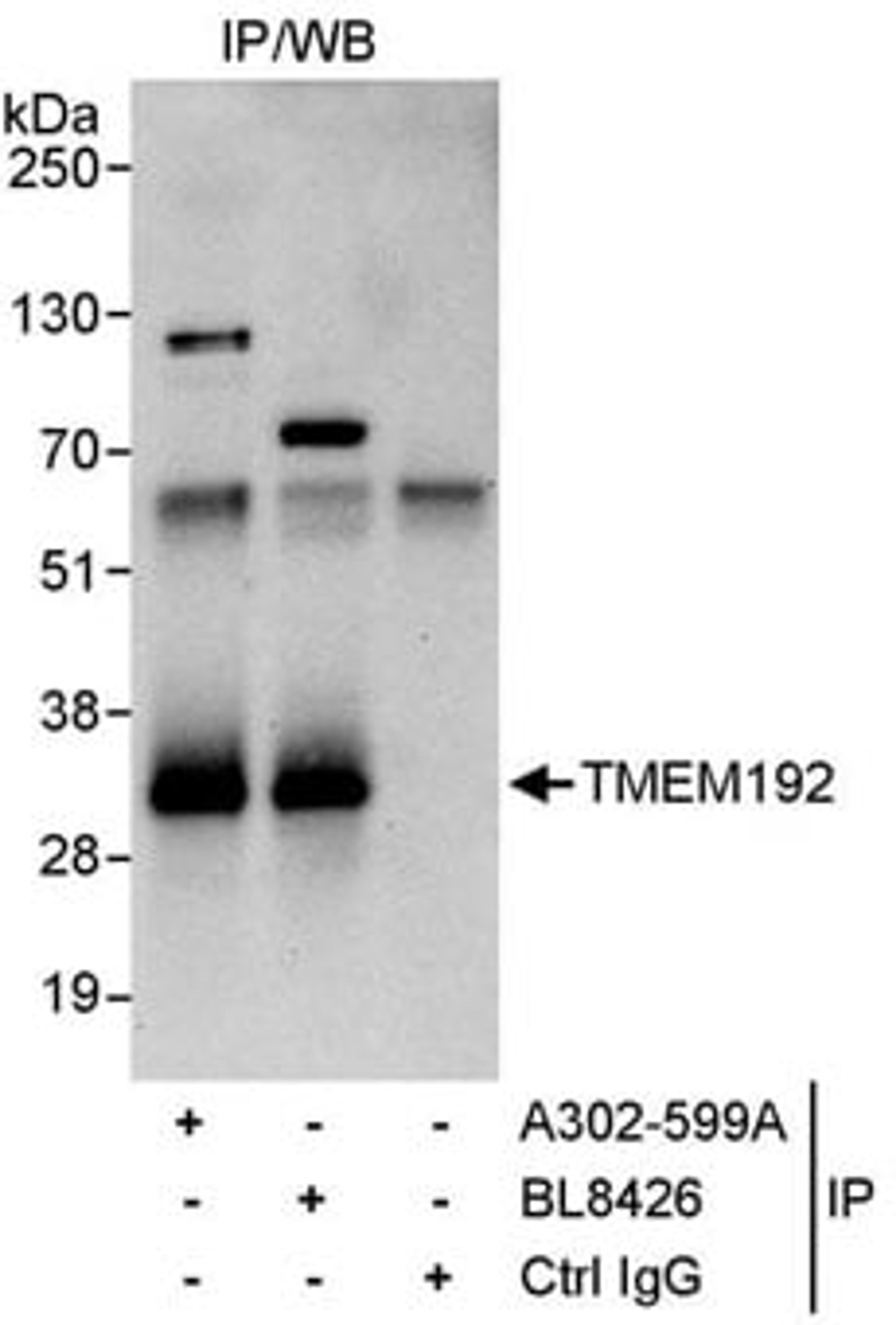 Detection of human TMEM192 by western blot of immunoprecipitates.