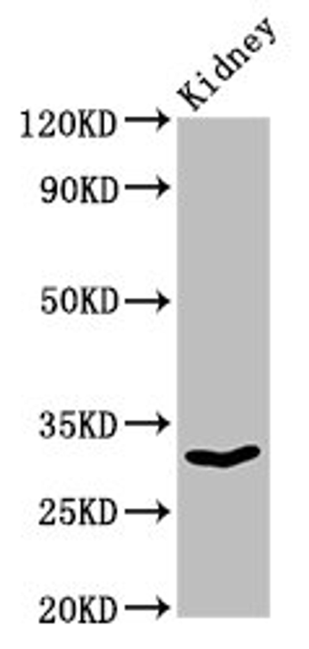 Western Blot. Positive WB detected in: Rat kidney tissue. All lanes: OLR1 antibody at 3µg/ml. Secondary. Goat polyclonal to rabbit IgG at 1/50000 dilution. Predicted band size: 31, 21, 22 kDa. Observed band size: 31 kDa