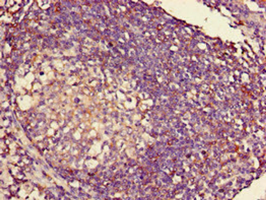 Immunohistochemistry of paraffin-embedded human lymph node tissue using CSB-PA15099D0Rb at dilution of 1:100