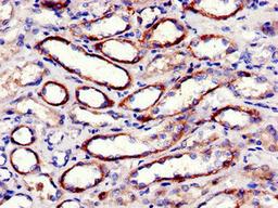 Immunohistochemistry of paraffin-embedded human kidney tissue using CSB-PA018994LA01HU at dilution of 1:100