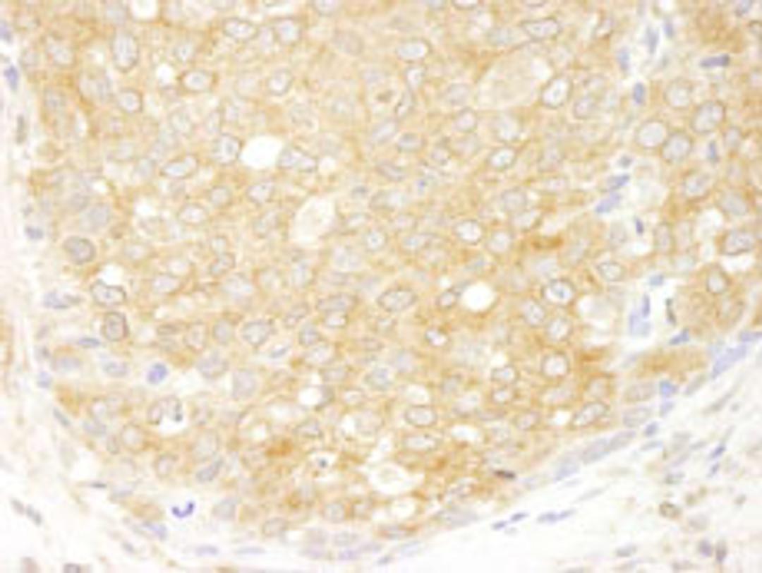 Detection of human eIF2beta/EIF2S2 by immunohistochemistry.