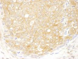 Detection of human eIF2beta/EIF2S2 by immunohistochemistry.