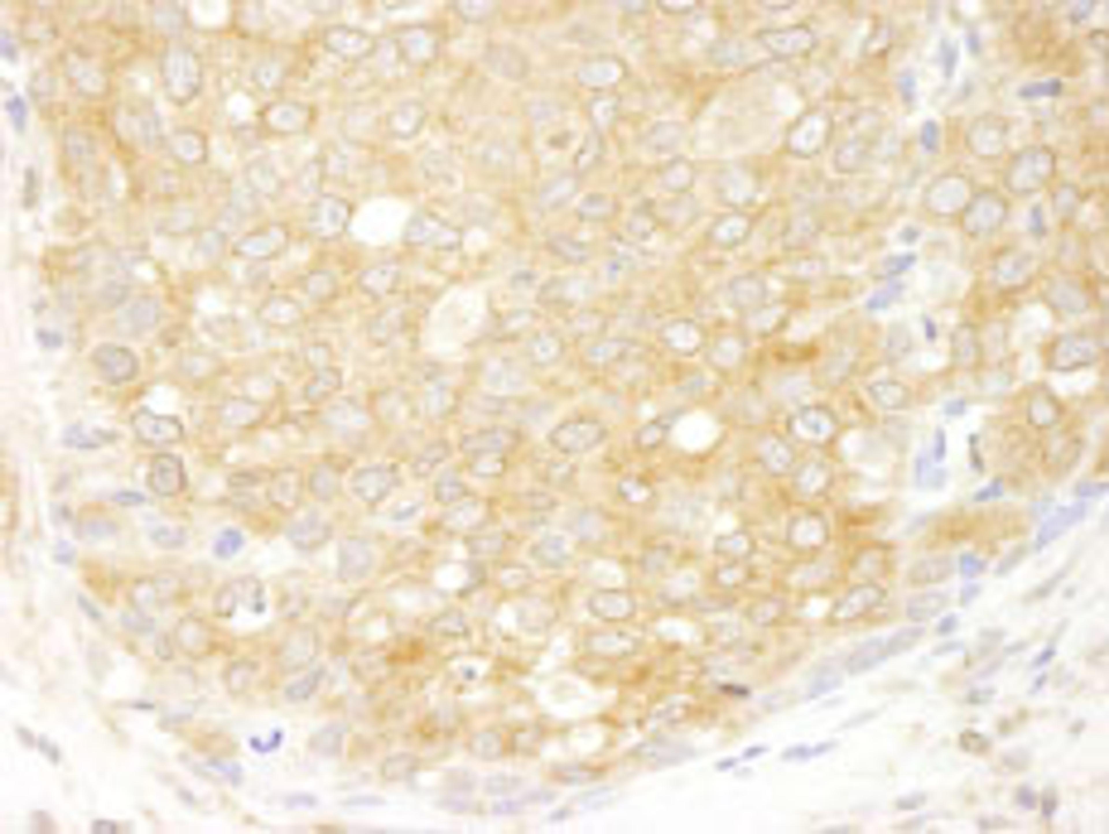 Detection of human eIF2beta/EIF2S2 by immunohistochemistry.