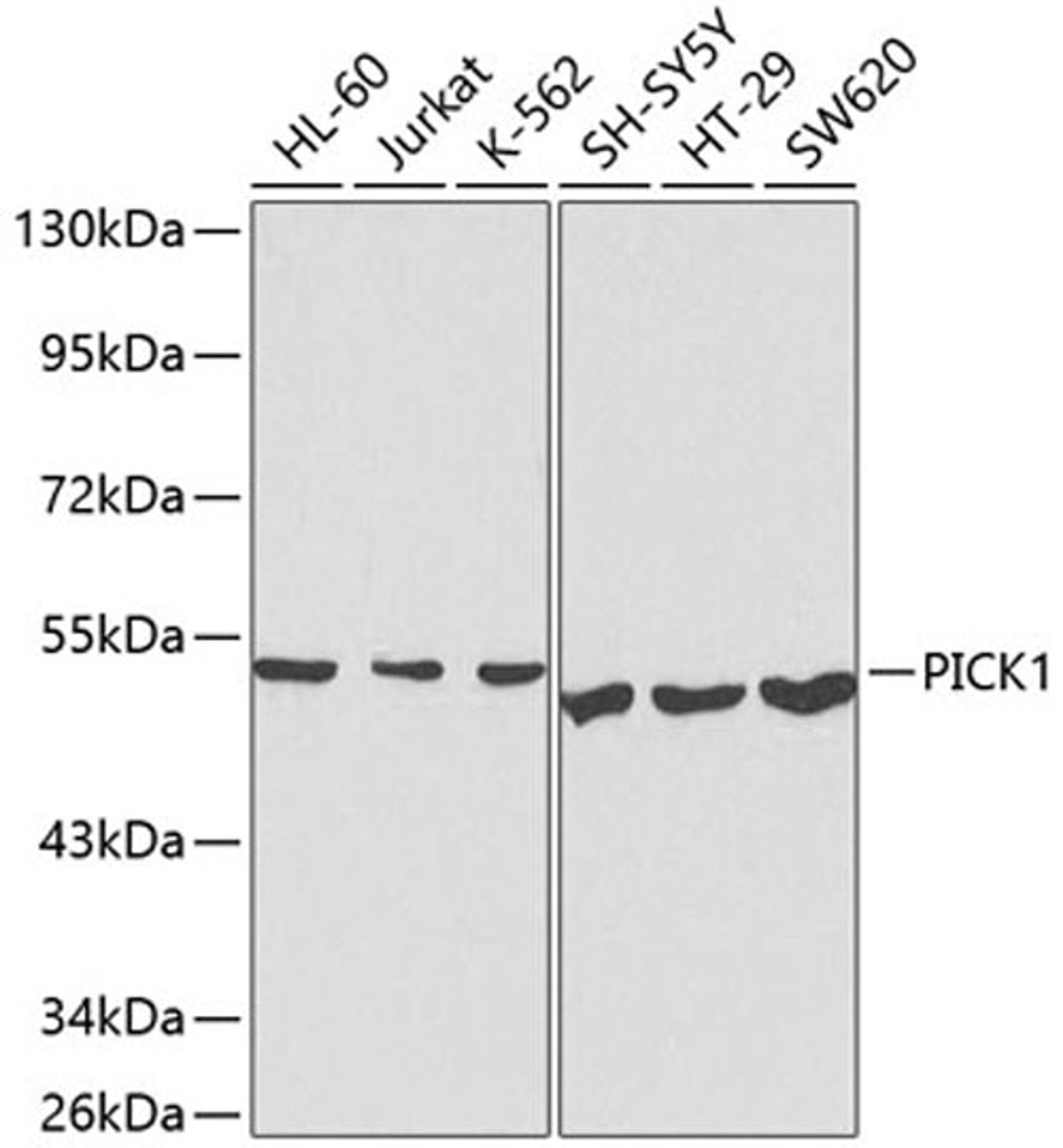 Western blot - PICK1 antibody (A1519)