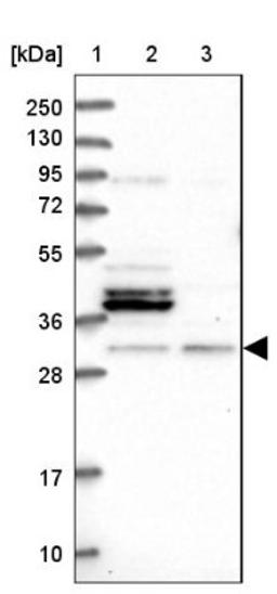 Western Blot: FUS2 Antibody [NBP1-89812] - Lane 1: Marker [kDa] 250, 130, 95, 72, 55, 36, 28, 17, 10<br/>Lane 2: Human cell line RT-4<br/>Lane 3: Human cell line U-251MG sp