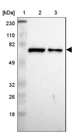 Western Blot: IGF2BP3 Antibody [NBP1-84339] - Lane 1: Marker [kDa] 230, 110, 82, 49, 32, 26, 18<br/>Lane 2: Human cell line RT-4<br/>Lane 3: Human cell line U-251MG sp