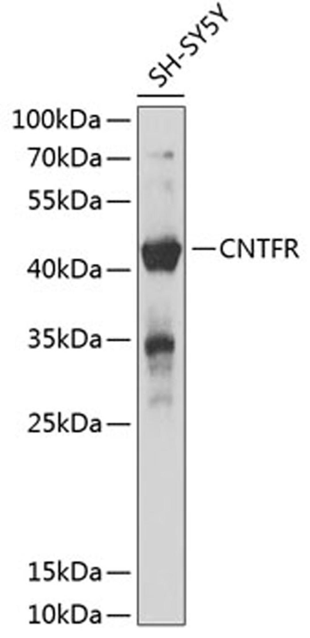 Western blot - CNTFR antibody (A12424)