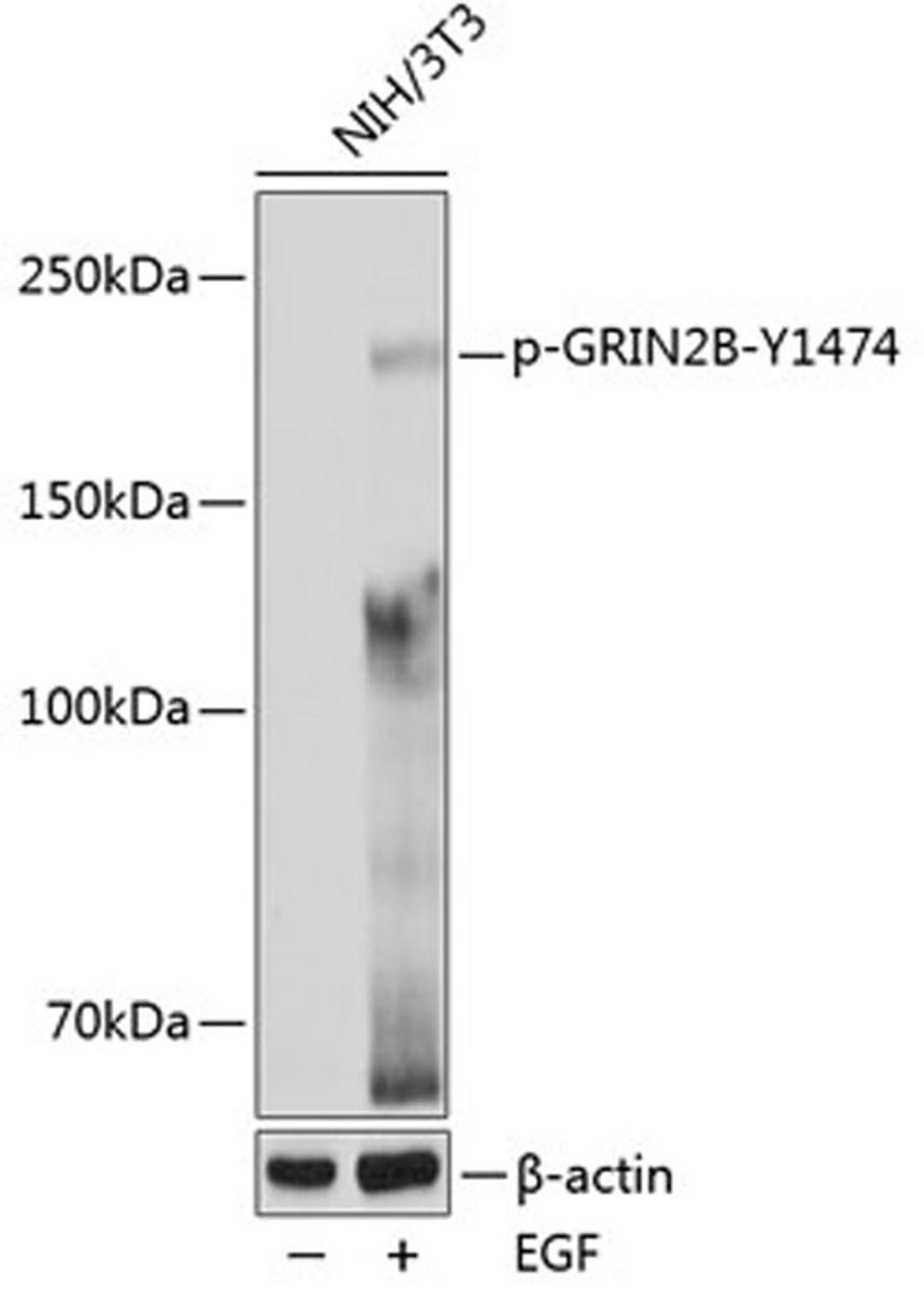 Western blot - Phospho-GRIN2B-Y1474 pAb (AP0771)