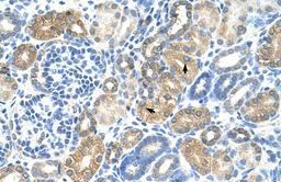 Antibody used in IHC on Human kidney.