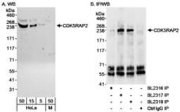 Detection of human CDK5RAP2 by western blot and immunoprecipitation.