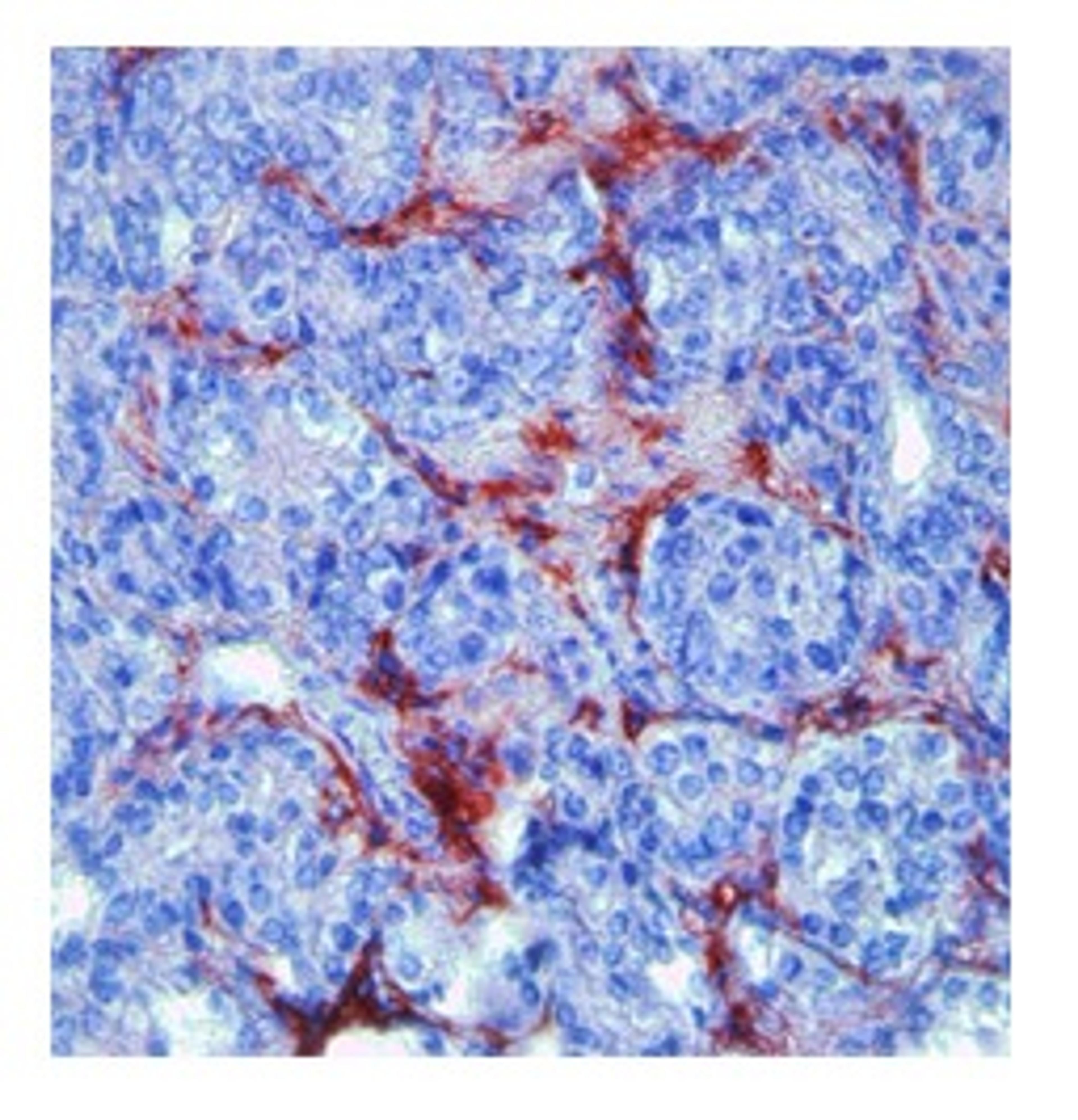 Antibody used in IHC on Mouse prostate cancer at 2-15 ug/ml.