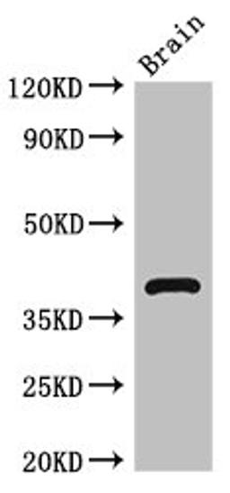 Western Blot. Positive WB detected in: Mouse brain tissue. All lanes: HOMER3 antibody at 2.7ug/ml. Secondary. Goat polyclonal to rabbit IgG at 1/50000 dilution. Predicted band size: 40, 17, 14, 36 kDa. Observed band size: 40 kDa. 