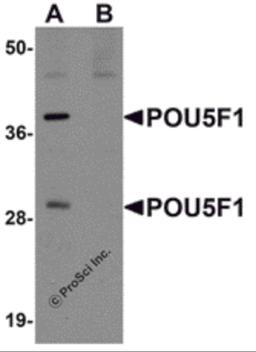 Western blot analysis of POU5F1 in mouse liver tissue lysate with POU5F1 antibody at 1 μg/ml in (A) the absence and (B) the presence of blocking peptide.