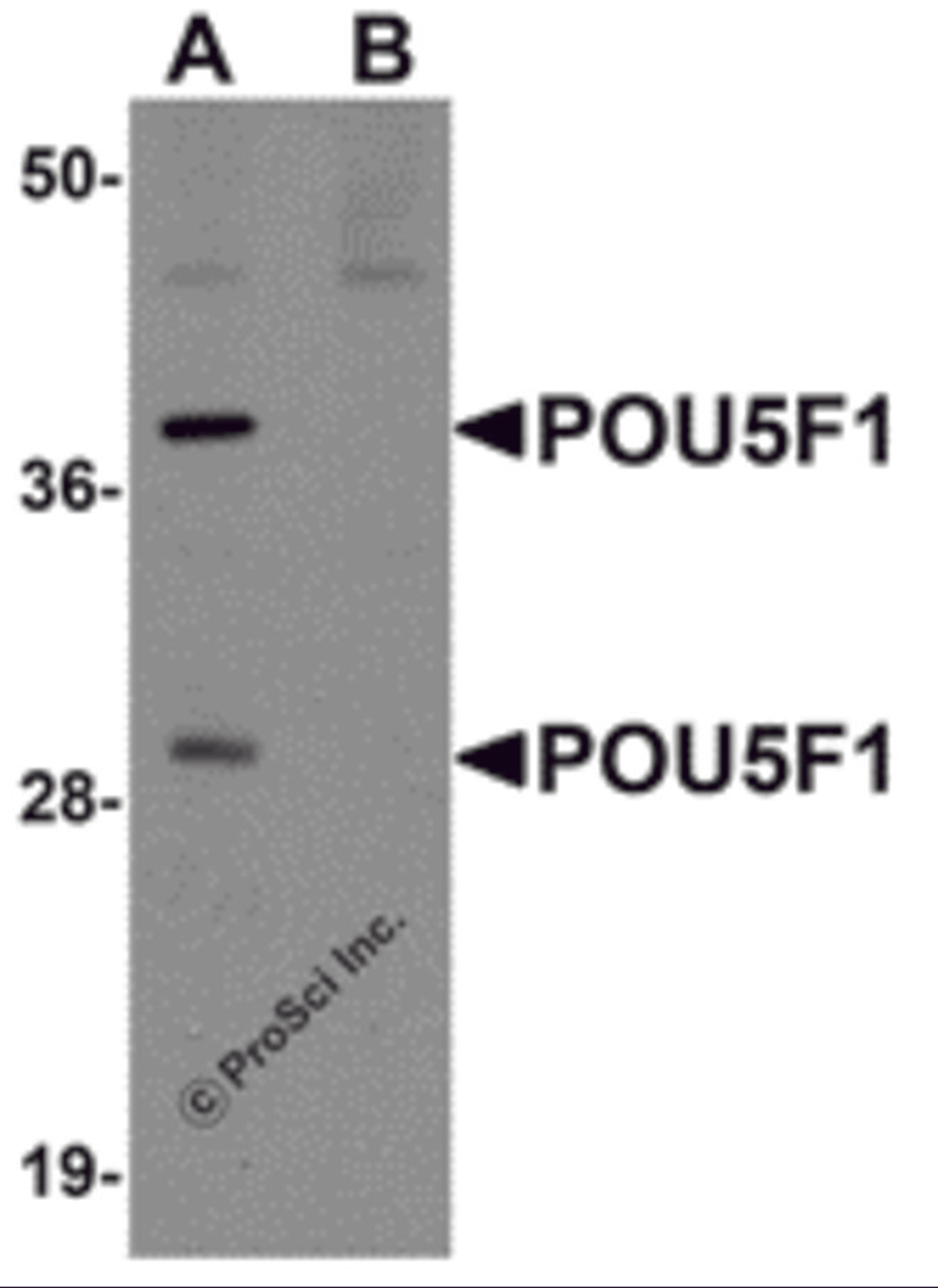 Western blot analysis of POU5F1 in mouse liver tissue lysate with POU5F1 antibody at 1 μg/ml in (A) the absence and (B) the presence of blocking peptide.