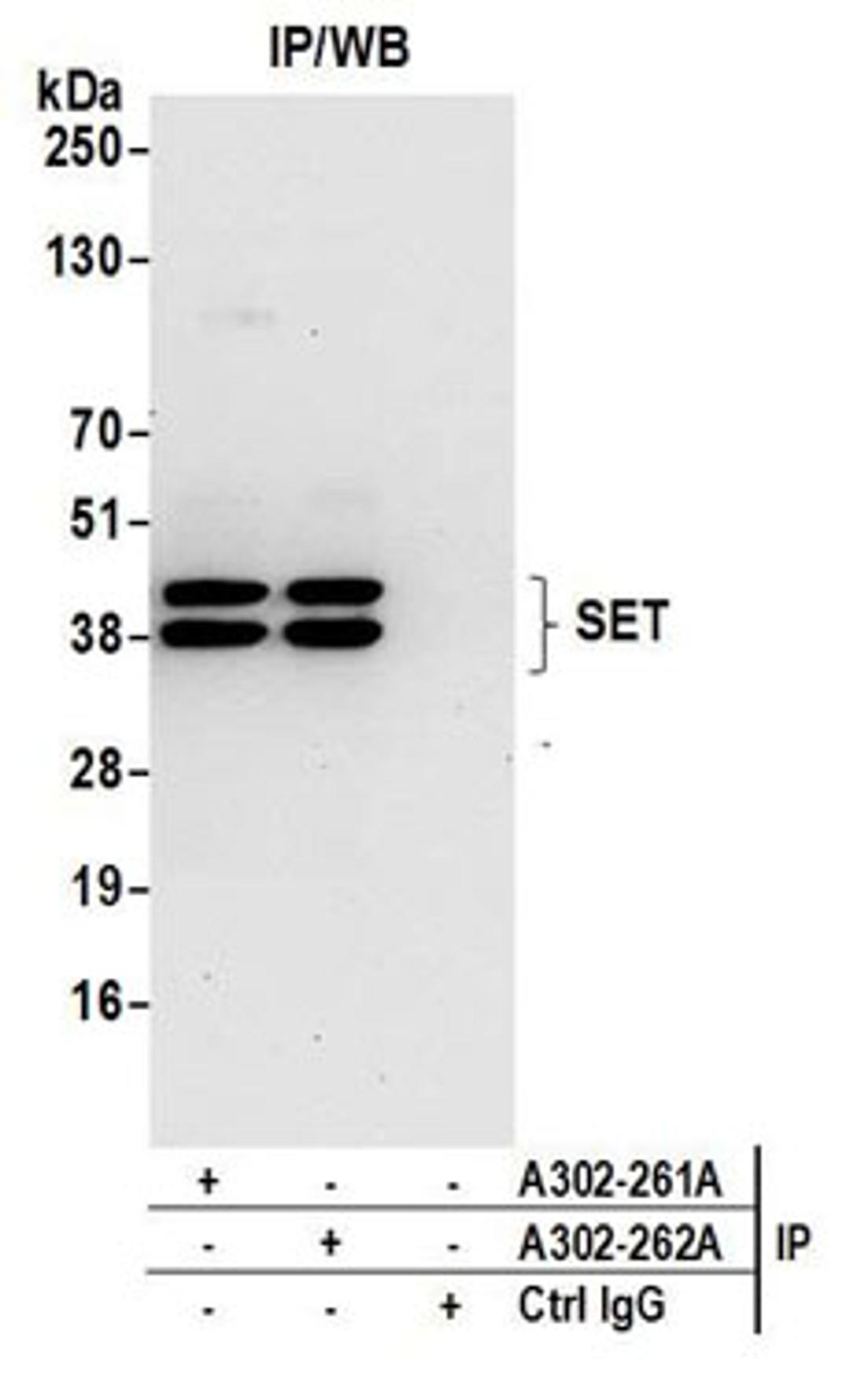 Detection of human SET by western blot of immunoprecipitates.