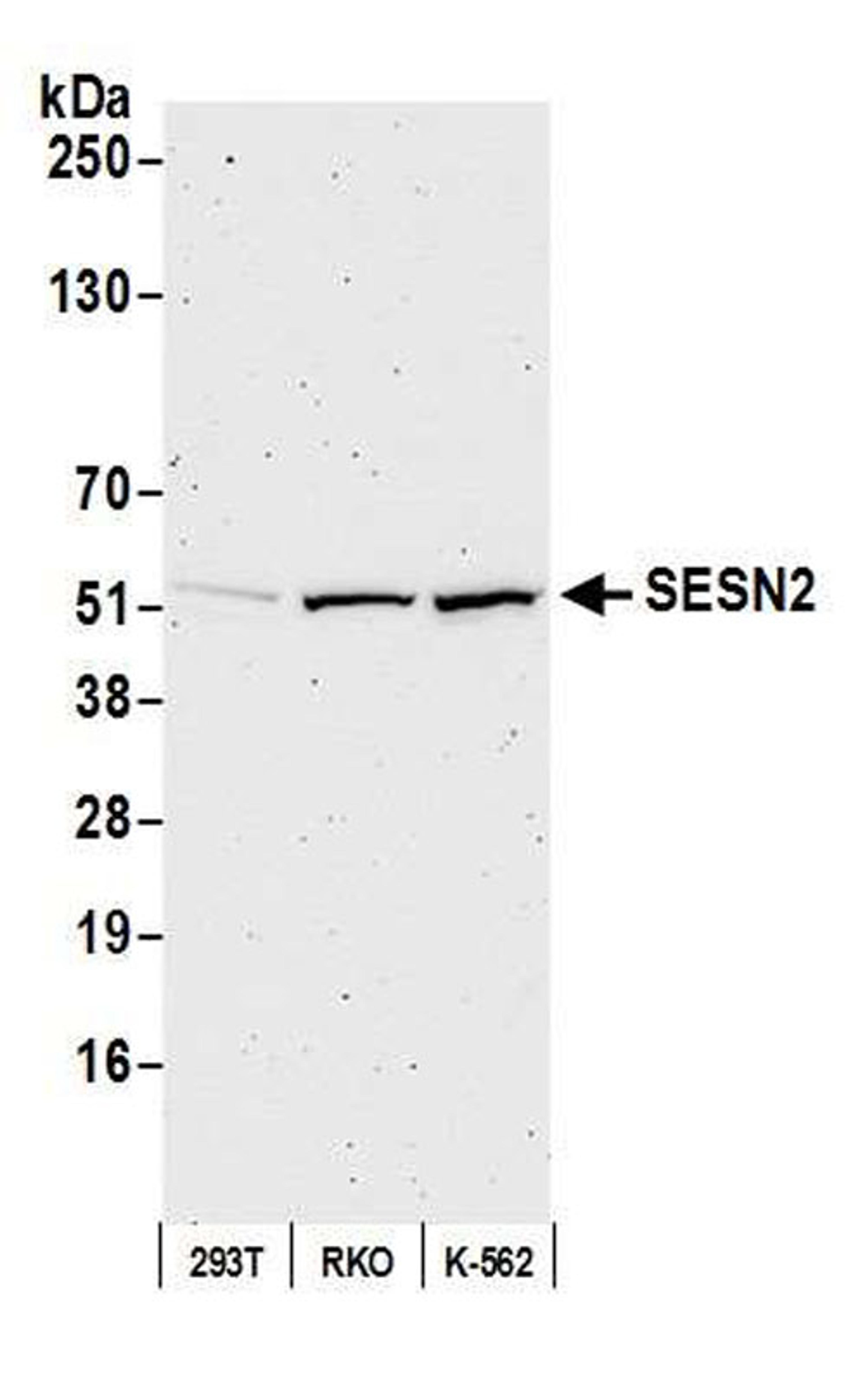 Detection of human SESN2 by WB.