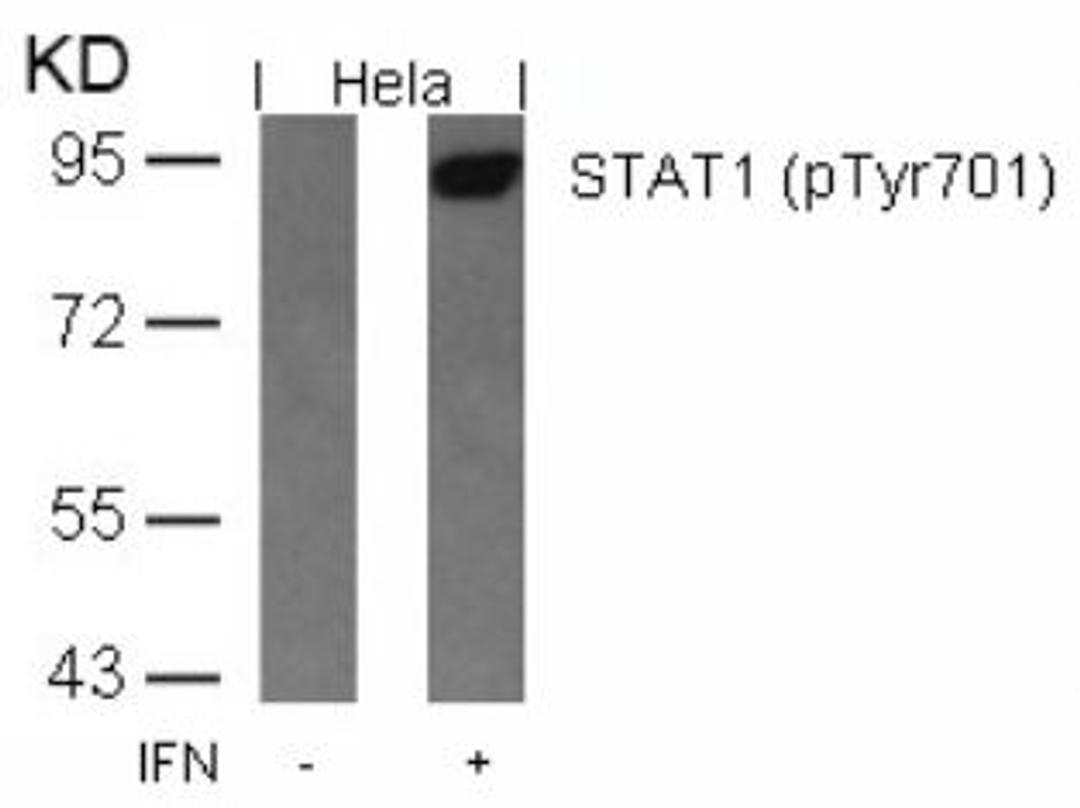 Western blot analysis of lysed extracts from HeLa cells untreated or treated with IFN using STAT1 (Phospho-Tyr701).