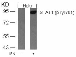 Western blot analysis of lysed extracts from HeLa cells untreated or treated with IFN using STAT1 (Phospho-Tyr701).