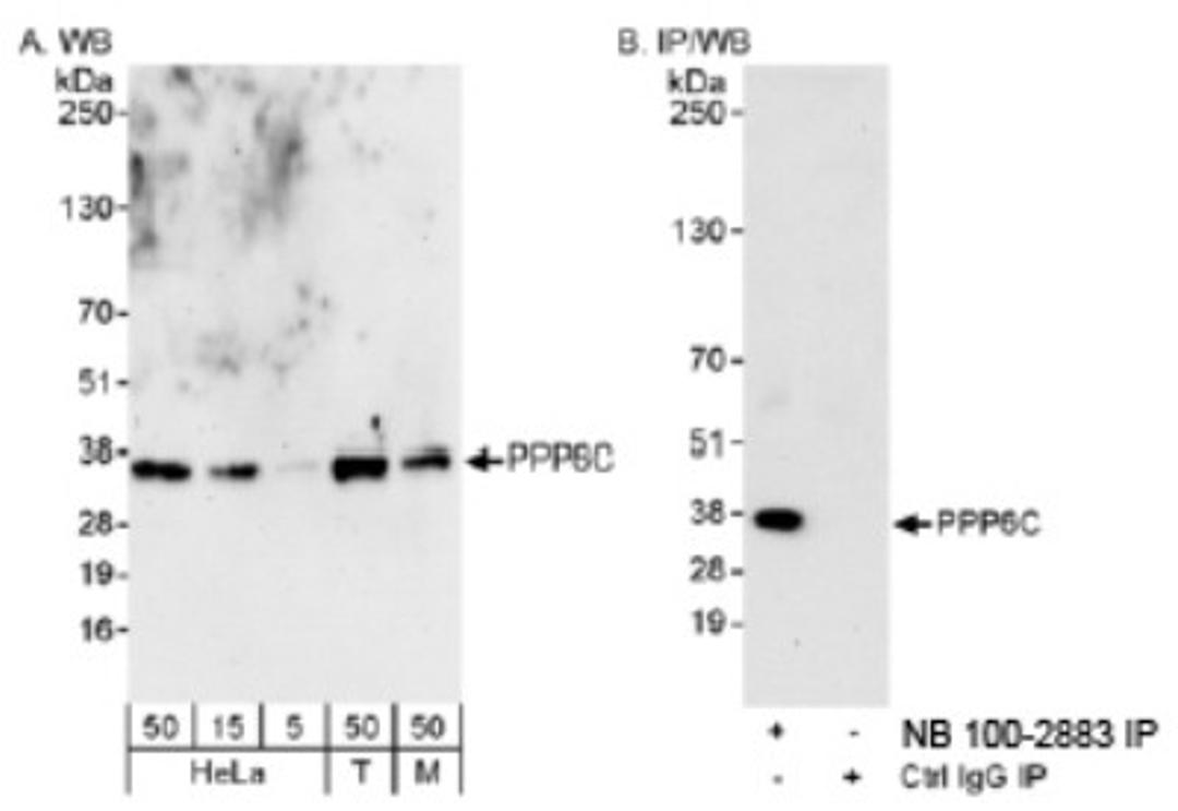 Western Blot: PPP6C Antibody [NB100-2883] - Detection of Human and Mouse PPP6C on HeLa whole cell lysate using NB100-2883.