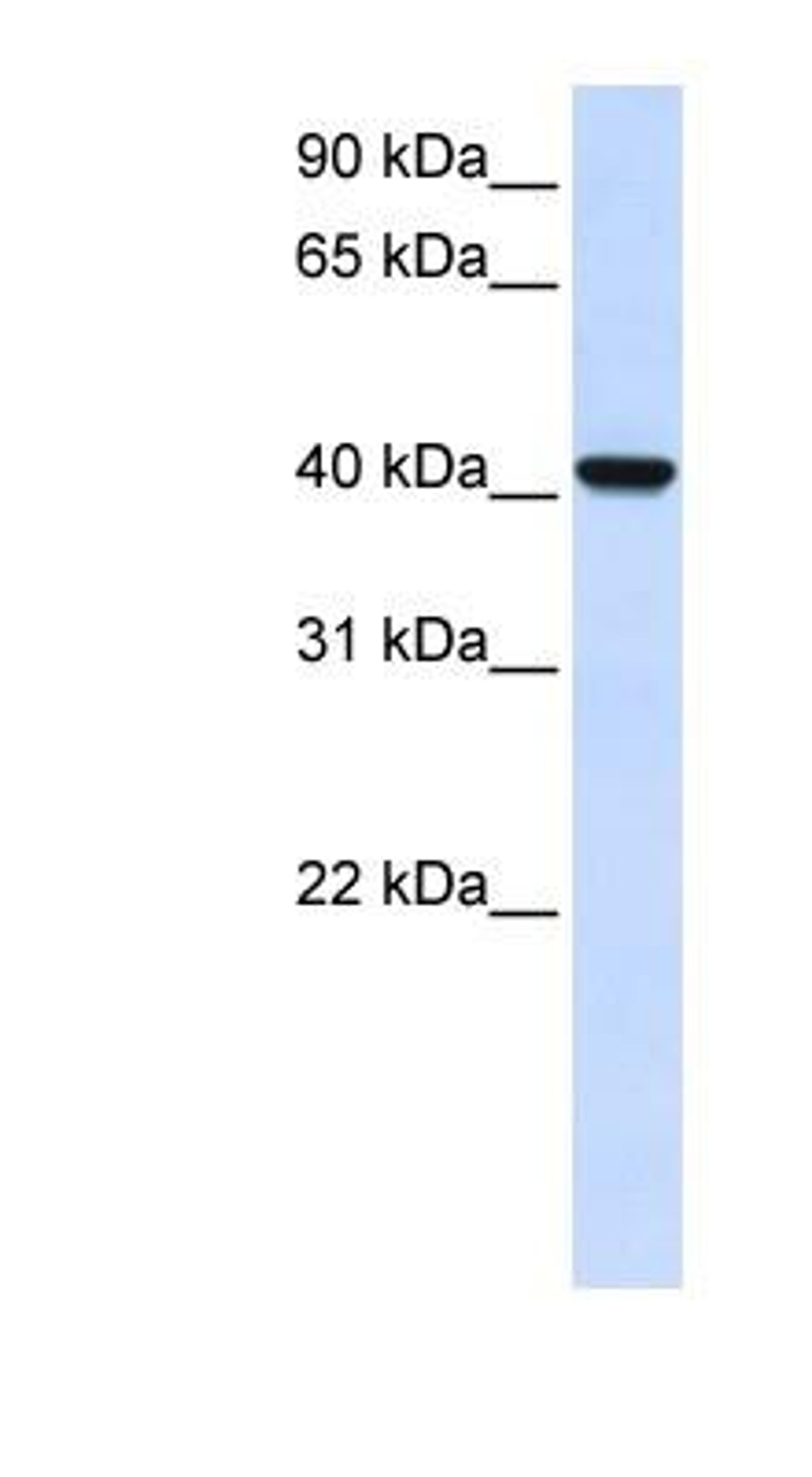 Western Blot: AWAT2 Antibody [NBP1-91574] - Human Brain lysate, concentration 0.2-1 ug/ml.