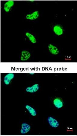 Immunocytochemistry/Immunofluorescence: UAP56 Antibody [NBP1-31356] - Analysis of HeLa, using NBP1-31356 at 1:200 dilution.