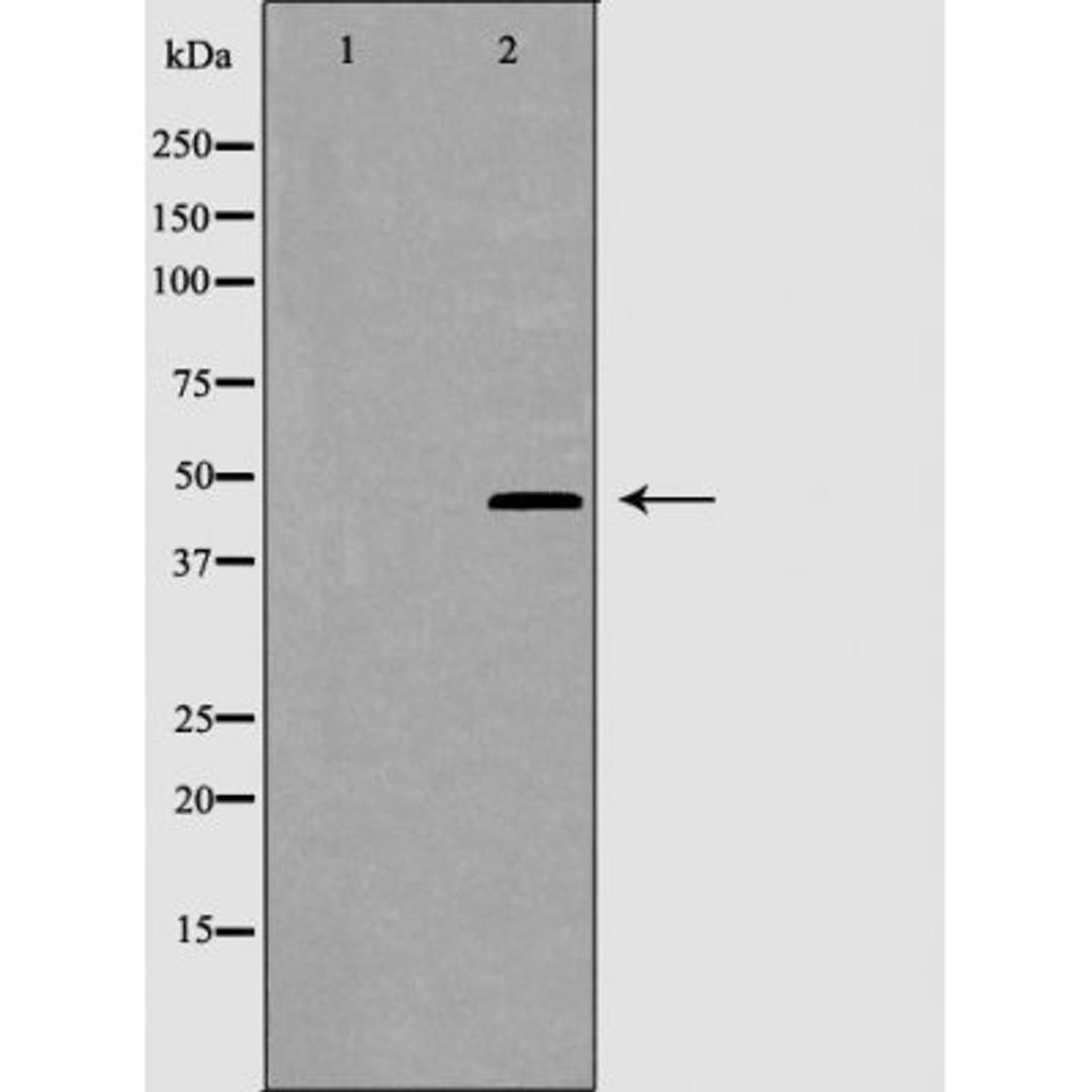 Western blot analysis of K562 cells using CRFR2 antibody